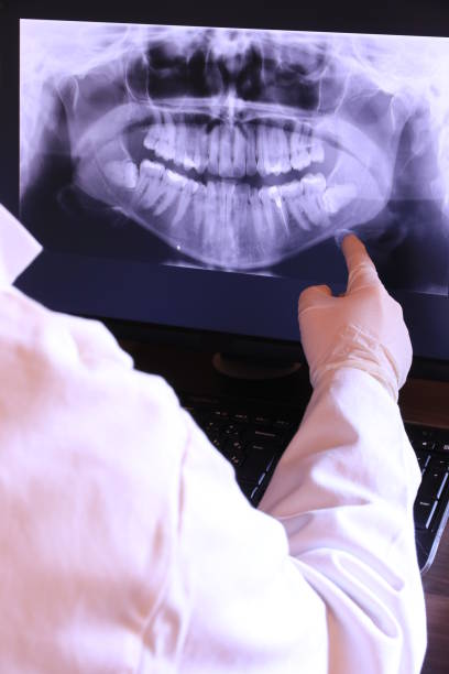 Best Emergency Treatment for Toothache in Irwin, PA